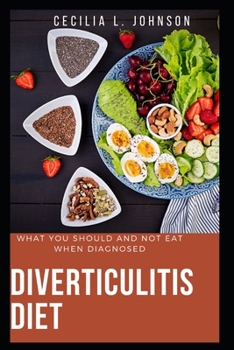 Paperback Diverticulitis Diet: What You Should And Not Eat When Diagnosed Book