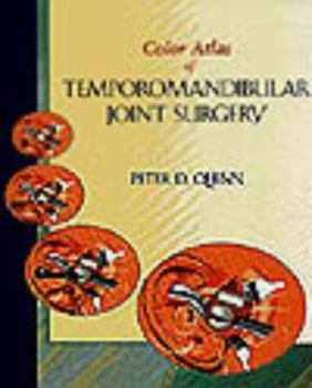 Hardcover Color Atlas of Temporomandibular Joint Surgery Book