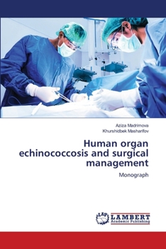 Paperback Human organ echinococcosis and surgical management Book