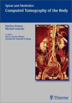 Hardcover Spiral and Multislice Computed Tomography of the Body Book