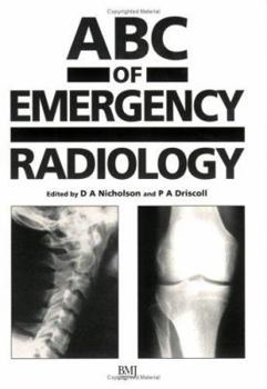 Paperback ABC of Emergency Radiology Book