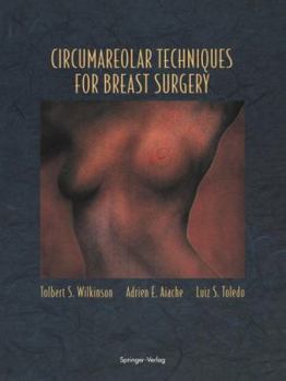 Paperback Circumareolar Techniques for Breast Surgery Book