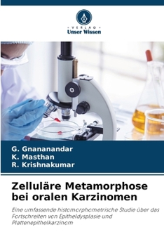 Paperback Zelluläre Metamorphose bei oralen Karzinomen [German] Book