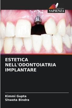 Estetica Nell'odontoiatria Implantare (Italian Edition)