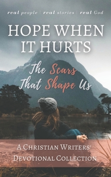 Paperback Hope When it Hurts: The Scars that Shape Us: A Christian Writers' Collection Book