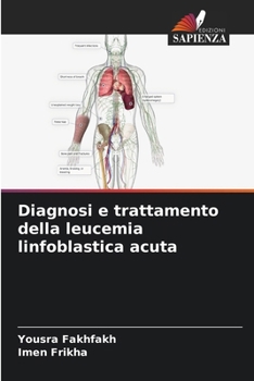 Paperback Diagnosi e trattamento della leucemia linfoblastica acuta [Italian] Book