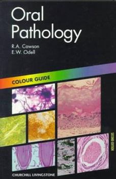 Paperback Oral Pathology: Colour Guide Book
