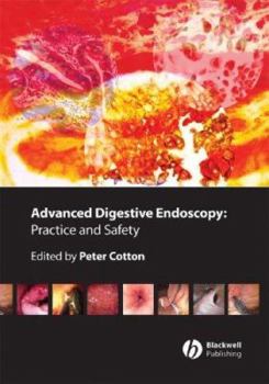 Hardcover Advanced Digestive Endoscopy: Practice & Safety Book