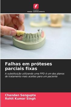 Paperback Falhas em próteses parciais fixas [Portuguese] Book