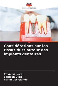 Paperback Considérations sur les tissus durs autour des implants dentaires [French] Book