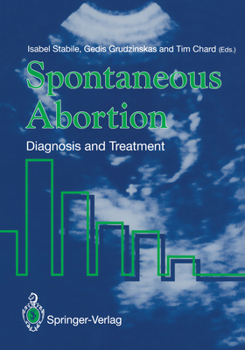 Paperback Spontaneous Abortion: Diagnosis and Treatment Book
