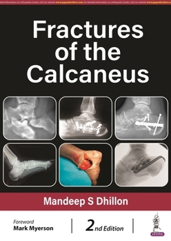 Hardcover Fractures of the Calcaneus Book