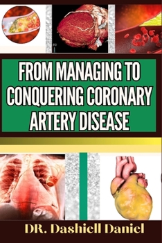 Paperback From Managing to Conquering Coronary Artery Disease: Expert Guide To Understanding The Causes, Recognizing Symptoms, And Implementing Effective Treatm Book