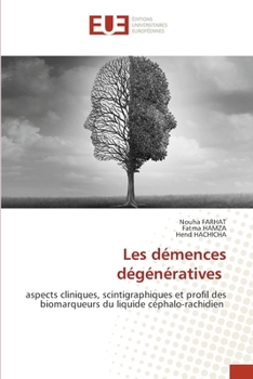 Les démences dégénératives (French Edition)