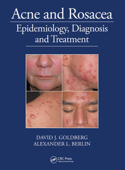 Paperback Acne and Rosacea: Epidemiology, Diagnosis and Treatment Book