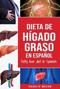 Paperback Dieta de hígado graso en español/Fatty liver diet in Spanish [Spanish] Book