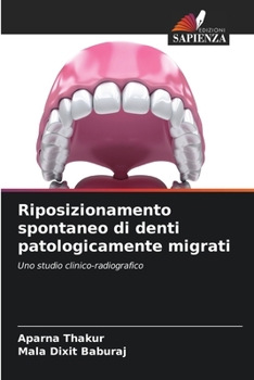 Paperback Riposizionamento spontaneo di denti patologicamente migrati [Italian] Book