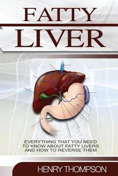 Paperback Fatty Liver: The Ultimate Step-By-Step Guide to Understanding and Reversing Fatty Liver Disease (Liver Cleanse, Nutrition, Liver Cl Book