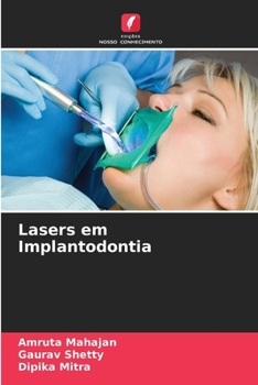 Paperback Lasers em Implantodontia [Portuguese] Book