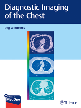 Hardcover Diagnostic Imaging of the Chest Book