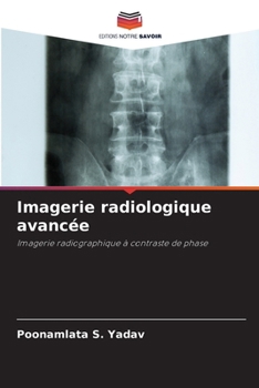 Imagerie radiologique avancée: Imagerie radiographique à contraste de phase (French Edition)