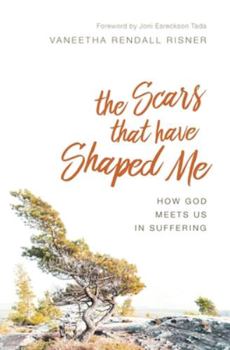 Paperback The Scars That Have Shaped Me: How God Meets Us in Suffering Book