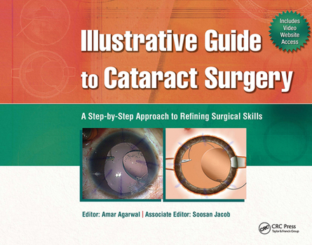 Hardcover Illustrative Guide to Cataract Surgery: A Step-By-Step Approach to Refining Surgical Skills Book