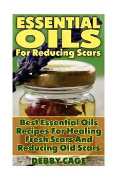 Paperback Essential Oils For Reducing Scars: Best Essential Oils Recipes For Healing Fresh Scars And Reducing Old Scars Book
