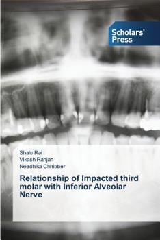 Paperback Relationship of Impacted third molar with Inferior Alveolar Nerve Book