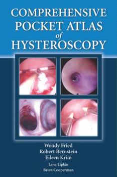 Paperback Comprehensive Pocket Atlas of Hysteroscopy [With CDROM] Book