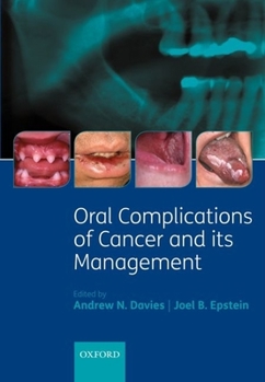 Hardcover Oral Complications of Cancer and Its Management Book