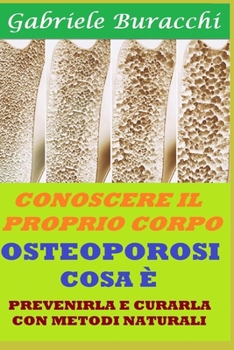 OSTEOPOROSI COSA È: PREVENIRLA E CURARLA CON METODI NATURALI (Conoscere il proprio corpo. Educazione alla salute)