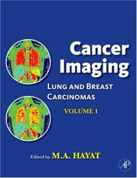 Hardcover Cancer Imaging: Lung and Breast Carcinomas Book