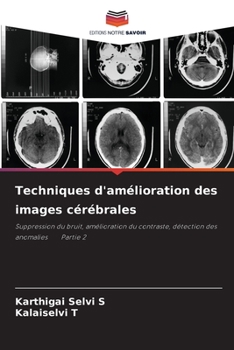 Paperback Techniques d'amélioration des images cérébrales [French] Book