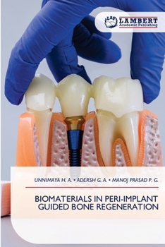 Paperback Biomaterials in Peri-Implant Guided Bone Regeneration Book