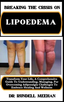 Paperback Breaking the Crisis on Lipoedema: Transform Your Life, A Comprehensive Guide To Understanding, Managing, For Overcoming Adiposalgia Challenges To Embr [Large Print] Book