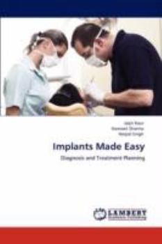 Paperback Implants Made Easy Book