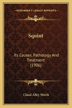 Paperback Squint: Its Causes, Pathology And Treatment (1906) Book