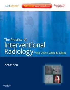 Hardcover The Practice of Interventional Radiology: With Online Cases and Videos [With Access Code] Book