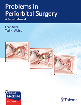 Hardcover Problems in Periorbital Surgery: A Repair Manual Book
