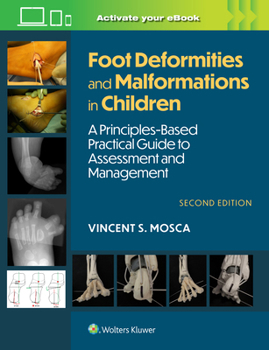 Hardcover Foot Deformities and Malformations in Children: A Principles-Based, Practical Guide to Assessment and Management: Print + eBook with Multimedia Book