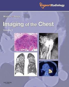 Hardcover Imaging of the Chest, 2-Volume Set: Expert Radiology Series Book