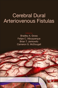 Paperback Cerebral Dural Arteriovenous Fistulas Book