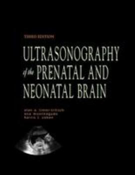 Ultrasonography of the Prenatal and Neonatal Brain