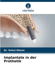 Paperback Implantate in der Prothetik [German] Book
