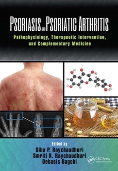 Paperback Psoriasis and Psoriatic Arthritis: Pathophysiology, Therapeutic Intervention, and Complementary Medicine Book