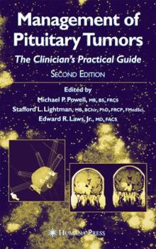 Hardcover Management of Pituitary Tumors: The Clinician's Practical Guide Book