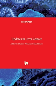 Hardcover Updates in Liver Cancer Book
