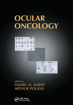 Paperback Ocular Oncology Book