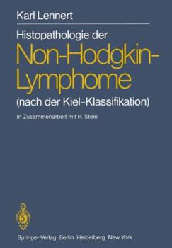 Paperback Histopathologie Der Non-Hodgkin-Lymphome: (Nach Der Kiel-Klassifikation) Book